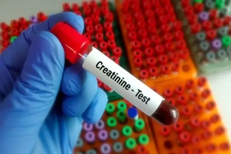 Preventing Kidney Problems and Managing Creatinine Levels