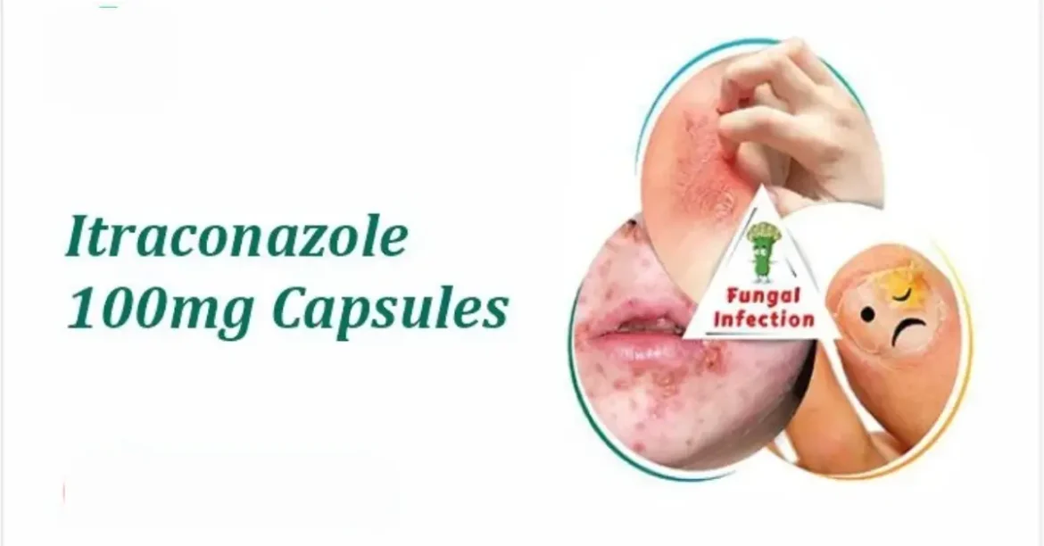 itraconazol