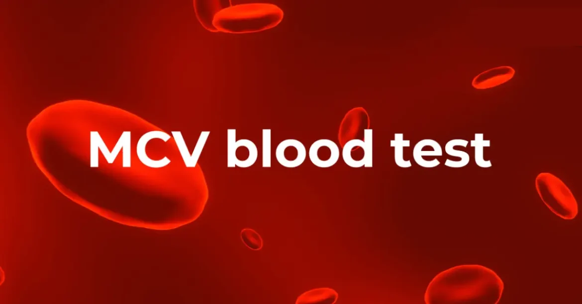 mcv blood test low results, meaning and normal range