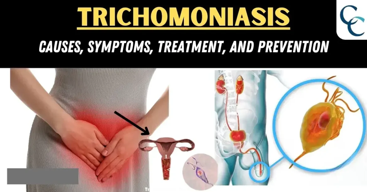 trichomonas vaginalis causes symptoms and treatment