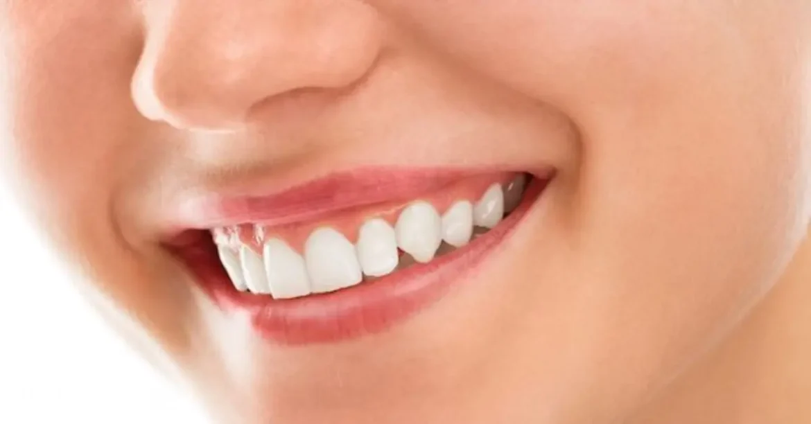 white spots on teeth causes, treatments & prevention